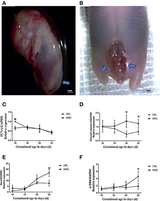 The Mechanism of Bladder Injury in Fetal Rats With Myelomeningocele